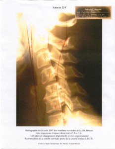 vertèbres cervicales